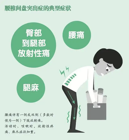 腰椎間盤突出癥典型癥狀