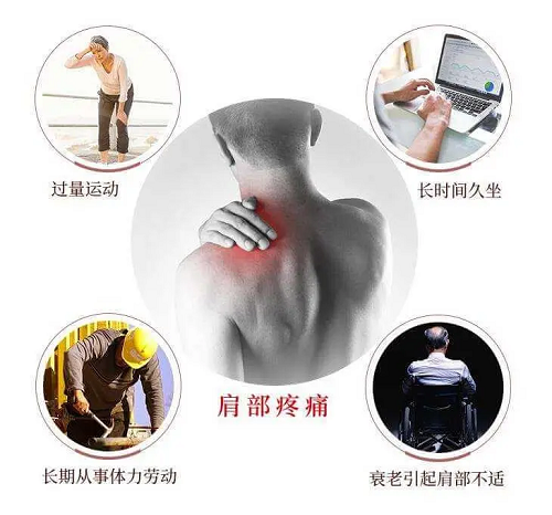 肩部疼痛常見原因