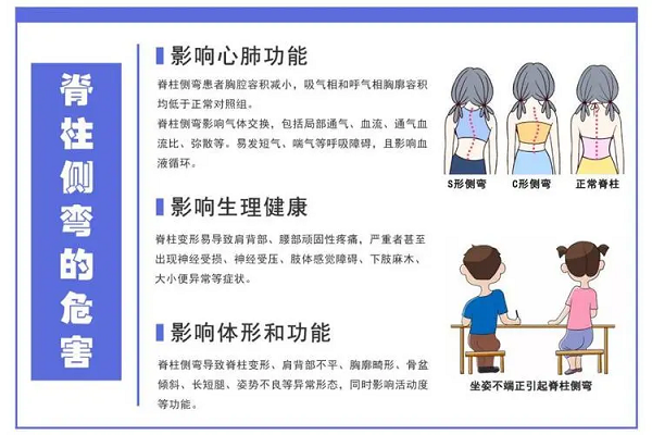 脊柱側(cè)彎危害
