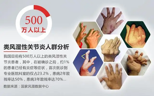 類風濕性關節(jié)炎人群分析