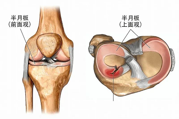 半月板前面觀上面觀